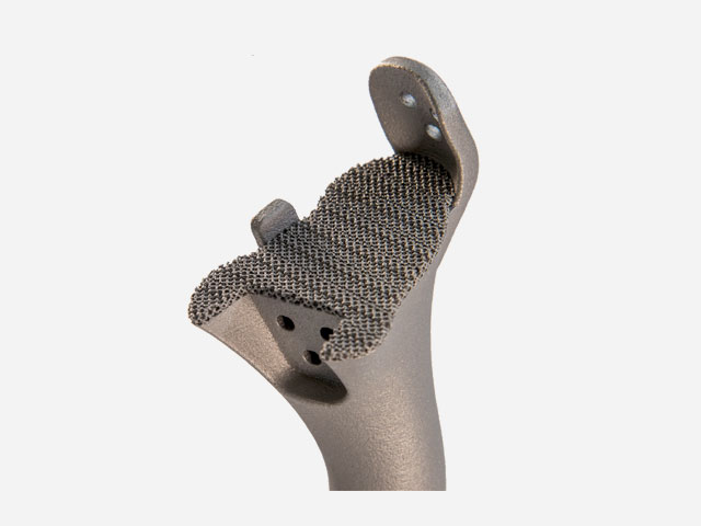 TC4 implant